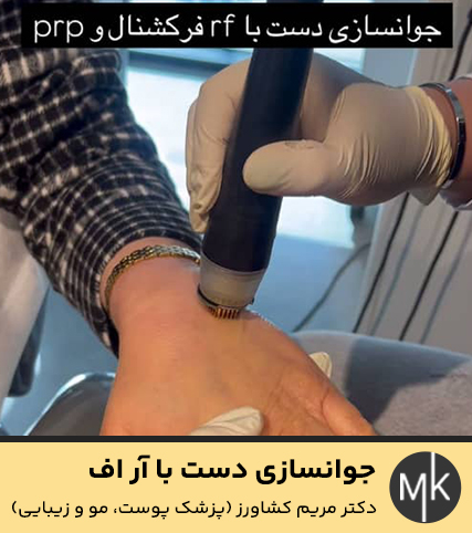 جوانسازی-دست-با-آر-اف