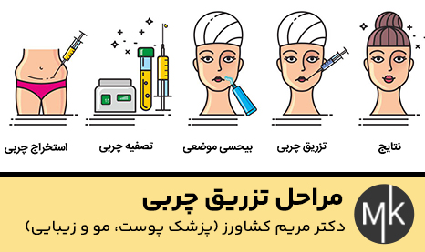 مراحل-تزریق-چربی
