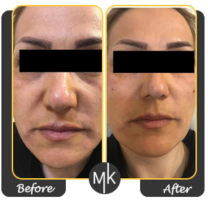 نمونه کار دکتر کشاورز