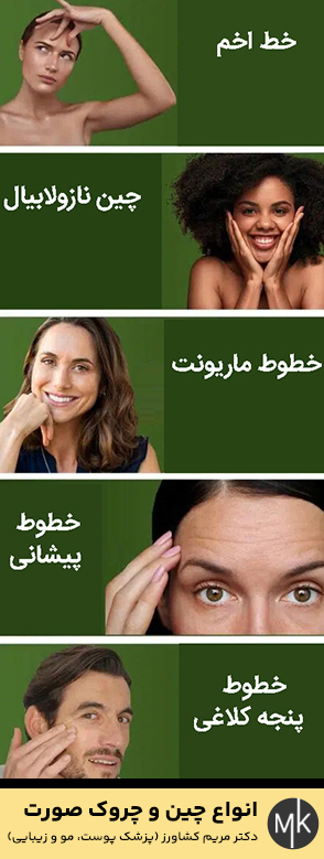 انواع-چین-و-چروک-صورت1
