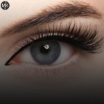 تزریق-بوتاکس-چشم-گربه-ای-در-اصفهان