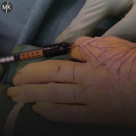 تزریق-چربی-به-دست