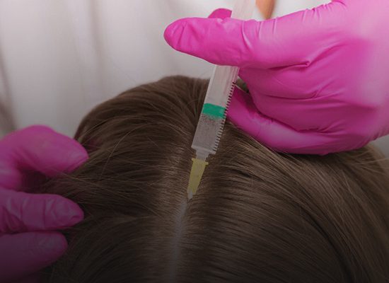 تفاوت-هیرفیلر-و-مزوتراپی-مو