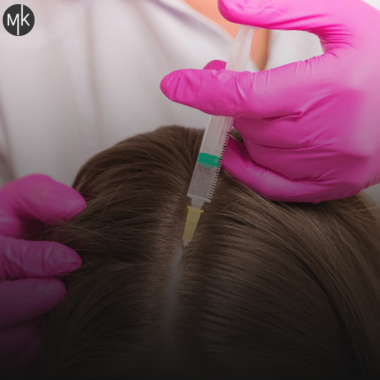 تفاوت-هیرفیلر-و-مزوتراپی-مو