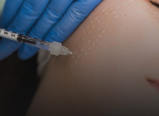 مزوتراپی-صورت-در-اصفهان