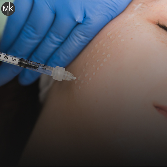 مزوتراپی-صورت-در-اصفهان