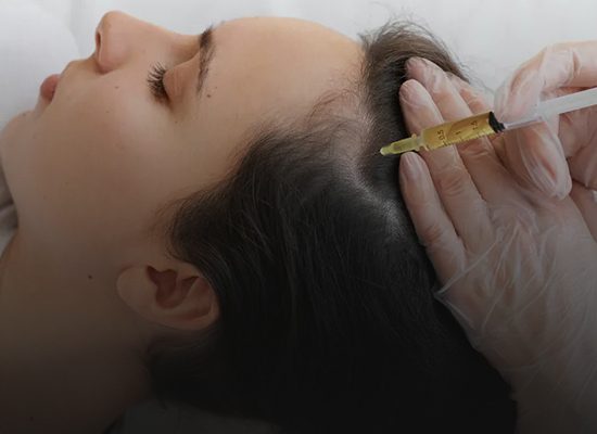 مزوتراپی-مو-در-اصفهان