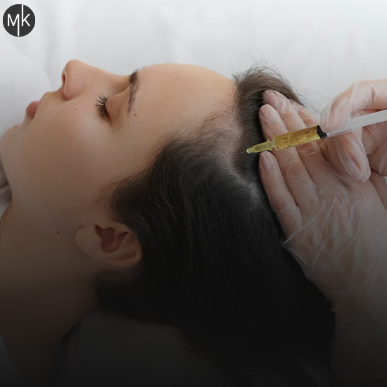 مزوتراپی-مو-در-اصفهان