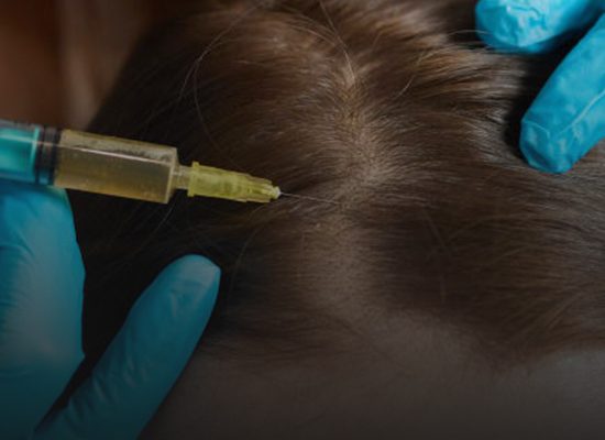 پی-آر-پی-مو-در-اصفهان