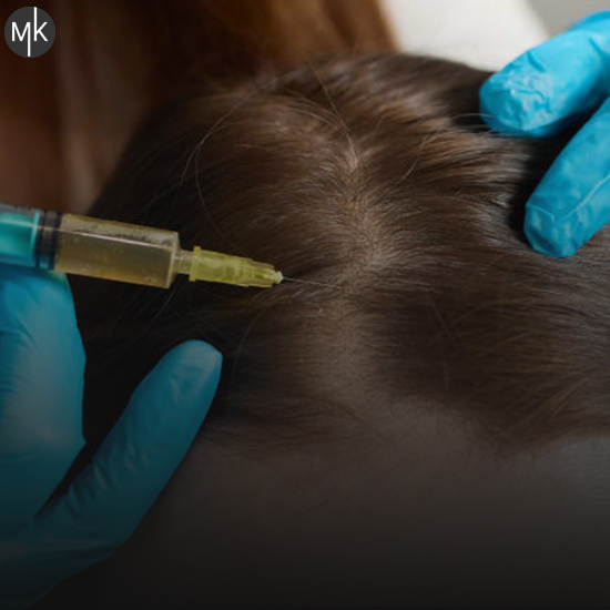 پی-آر-پی-مو-در-اصفهان