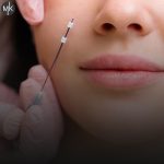 با-این-روشها-ماندگاری-لیفت-با-نخ-را-افزایش-دهید