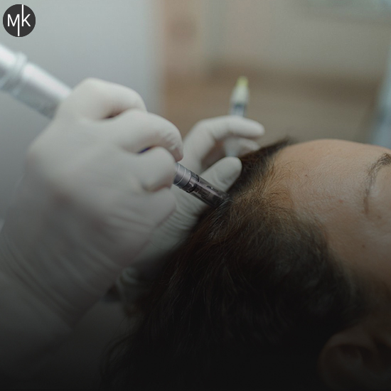 عکس-میکرونیدلینگ-پوست-سر
